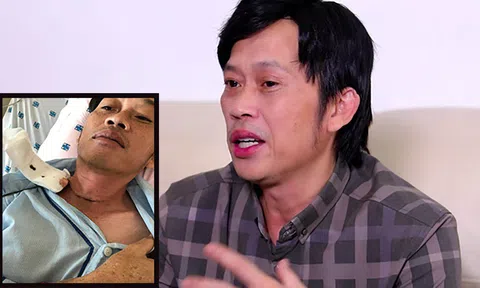Hoài Linh bất ngờ công bố từng bị ung thư tuyến giáp, CĐM phản ứng gay gắt